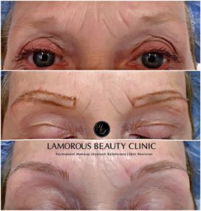 Lamorous Beauty Clinic Microblading